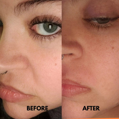 SilkTwist™ | Gladde Huid Zonder Mesjes of Chemicaliën |